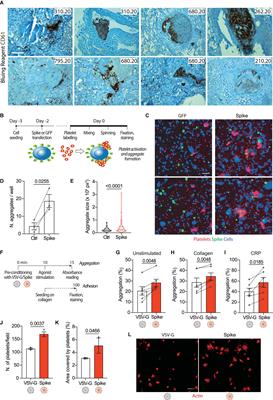 SARS-CoV-2 Spike protein activates TMEM16F-mediated platelet procoagulant activity